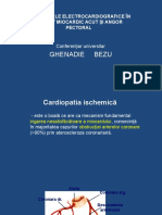 Ghenadie Bezu: Modificările Electrocardiografice În Infarct Miocardic Acut Și Angor Pectoral