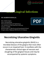 Acute Gingival Infections