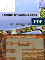 .Radiografi Rangka Dada