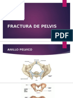 FRACTURA-DE-PELVIS Exposicion
