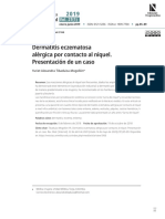 Dermatitis Eczematosa Alérgica Por Contacto Al Níquel. Presentación de Un Caso. Yuriet Alexandra Tibaduiza Mogollon