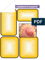 Fibroma Cementificante: Epidemologia ¿Que Es Un Fibroma?