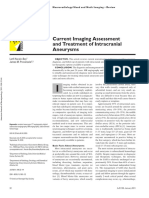 Aneurisma Intracraneal