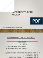 Sufrimiento Fetal Agudo