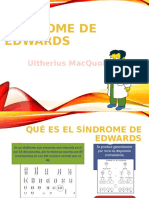 Sindrome de Edwards