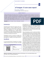 Haemangioma of Tongue: A Rare Case Report