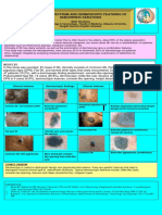 Clinical and Dermoscopic Features of Seborrheic Keratosis