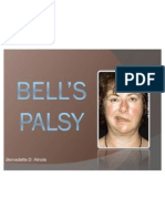 Bell's Palsy