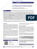 Histomorphology of Fallopian Tubes in Ectopic Pregnancy