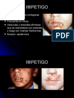 3 - Impetigo