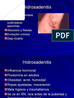 6 - Hidrosadenitis