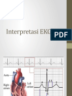 Interpretasi EKG