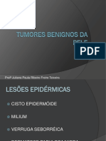 UC4 - Sistema Tegumentar -Tumores Benignos da Pele