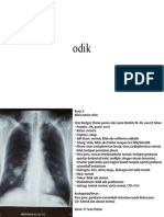 Baca X Ray Tumor Thorax