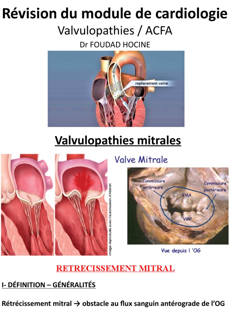 Valvulopathie  Fondation des maladies du cœur et de l'AVC