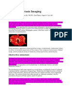 Lobar Atelectasis Imaging