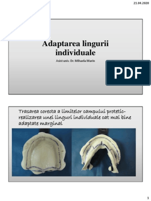 LP Mih M, Adaptare Lingura Individuala | PDF