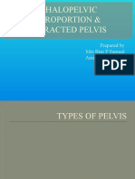 Cephalo Pelvic Disproportion (CPD) & Contracted Pelvis