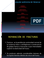 4. Gladis-Reparación de fracturas.pptx