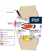 Schematic chronic-inflammation osteoarthritis