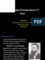 Sejarah Dan Prinsip CT Scan