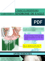 Sindrome de Eagle