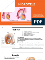 Hidrocele: causas, síntomas y tratamiento