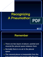 Recognizing pneumothorax