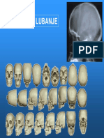 A2P2-BazaLubanje2