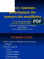 Aspect Anatomo-Pathologique Des Tumeurs Des Maxillaires