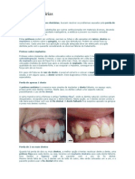 proteses_dentarias