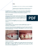 Proteses Dentarias