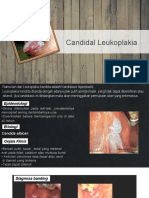 Candida Leukoplakia, Eritematus Akut&kronik