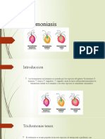 Tricomoniasis