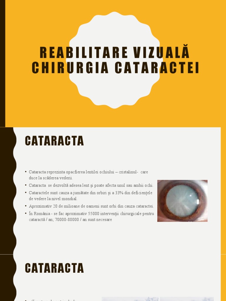 A doua etapă a acuității vizuale a cataractei