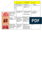 Cuadro Comparativo de Aftas