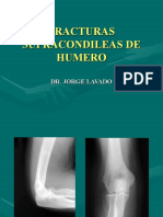 FRACTURAS SUPRACONDILEAS DE HUMERO (Autoguardado)