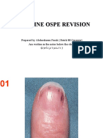 OSPE Medicine Revision 