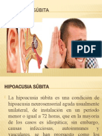 Tratamiento Hipoacusia Subita