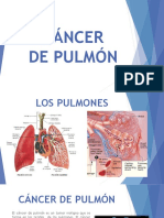 Cancer de Pulmon