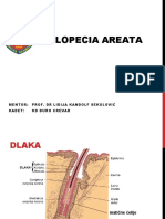 Alopecija Areata