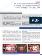 Comparison of Intrusion Effects On Maxillary Incisors Among Mini Implant Anchorage, J-Hook Headgear and Utility Arch