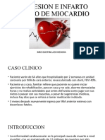 DEPRESION E INFARTO AGUDO DE MIOCARDIO.pptx