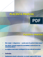 Placenta-praevia.ppt