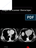 Pièges en Scanner Thoracique PDF