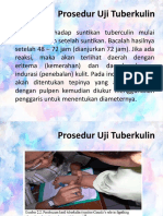 Prosedur Uji Tuberkulin