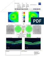 OS OD Macula Thickness OU: Macular Cube 512x128