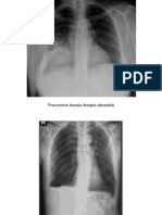 LP 2 Pulm Patologie Rom PDF