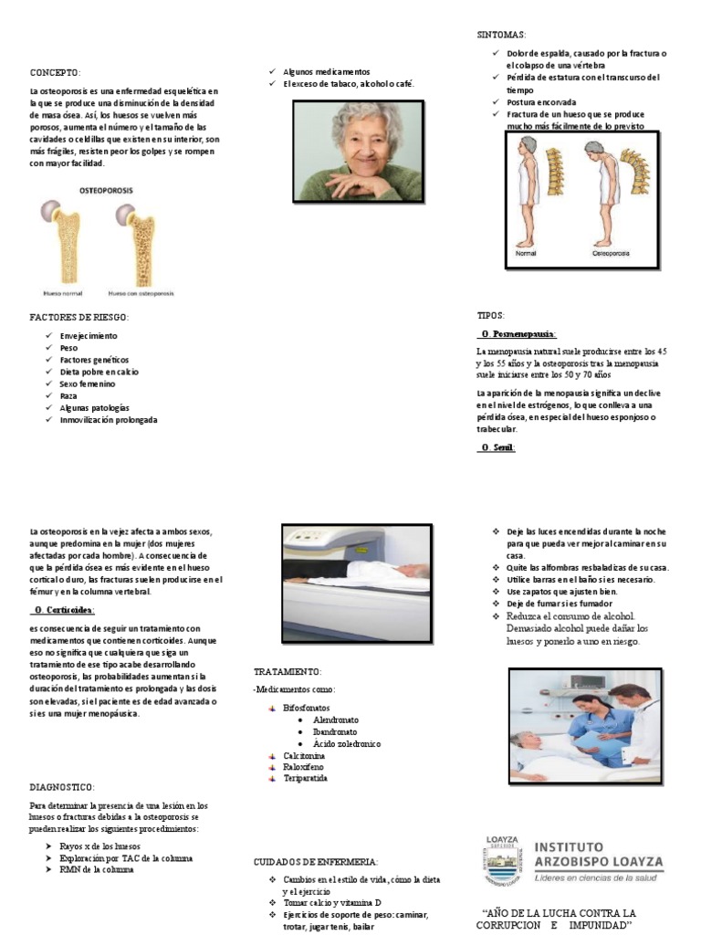 Guía Completa sobre Osteoporosis | PDF | Osteoporosis | Hueso