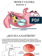 GASTRITIS Y ULCERA PEPTICA R